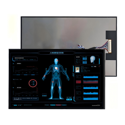 10.1-inç TFT LCD Ekranı - Endüstriyel ve Otomobil Kullanımı İçin Yüksek Çözümlü Dokunmatik Ekran